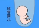 培养徐州捐卵宝宝艺术细胞的小技巧