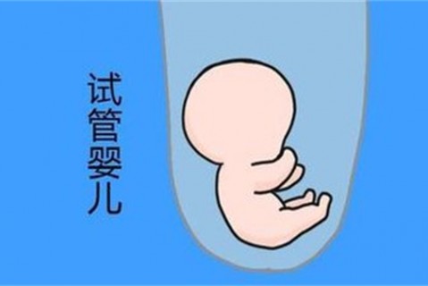 培养徐州捐卵宝宝艺术细胞的小技巧